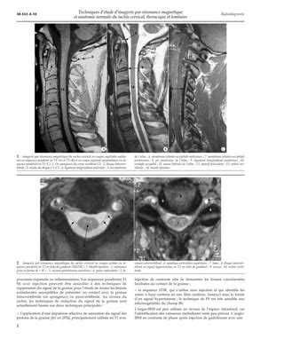 td 4am projet 2 séquence 1|Techniques d’IRM et anatomie normale du rachis cervical, thoracique et.